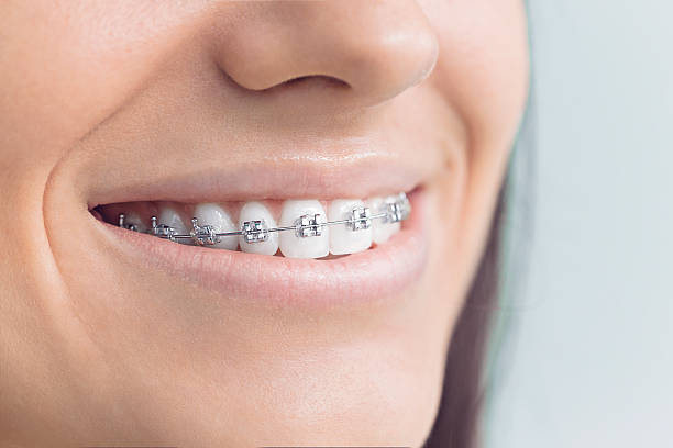 Trusted South Bend, IN Holistic Dental Care Services Experts